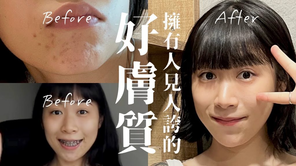 如何擁有人見人誇的好膚質|6招皮膚保養大公開