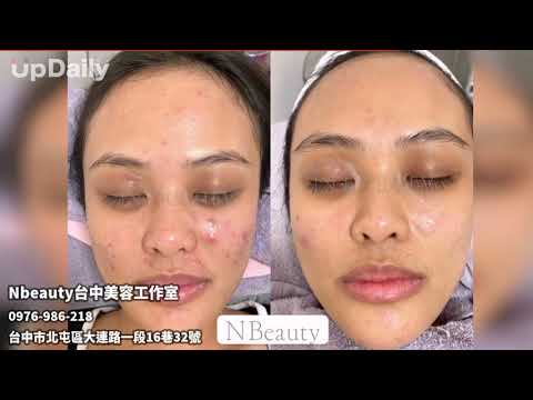 Nbeauty Taichung Beauty Studio 台中北屯杏酸護膚台中定制深層護膚台中耳燭Linba Gourai SPA
