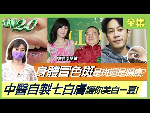倪匡皮膚癌逝味覺消失像死了9成!當心皮膚淋巴癌早期像濕疹!輕忽黑痣冒血竟皮膚癌奪命!身體冒色斑是斑?還是腸癌?中醫自製七白膚讓你美白一夏!健康2.0 20220821 (完整版)