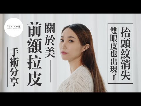 關於美的小秘訣:前額拉皮手術對眼皮鬆弛、抬頭紋有神奇效果! feat.馮中和院長|凡登整形外科