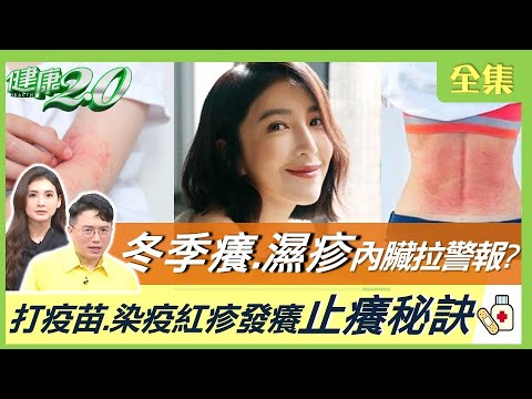 濕疹、過敏,是內心的警報嗎?打苗感染後紅斑疹預防小竅門!補充法令、血管栓塞健康2.0 20221126【完整版】姜昆君魏儒宗博才藝煥五明朱火宋梅萊義宗