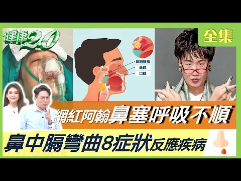 呼吸不規則的網紅鼻塞動態鼻手術!小心鼻子彎曲 8種懷舊症 顏色反應 急性鼻炎 可怕的失明!長期畸形口腔癌健康2.0 20221203【完整版】姜昆軍