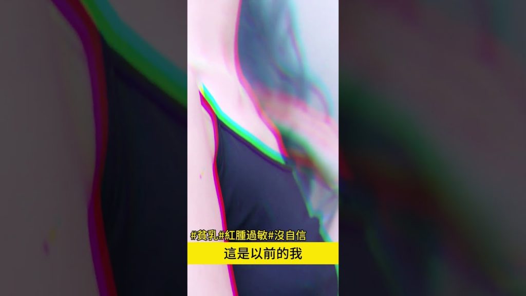 宅女僕變身性感精靈系正妹,隆乳手術的心得分享 台北教主 吳孟頴醫師