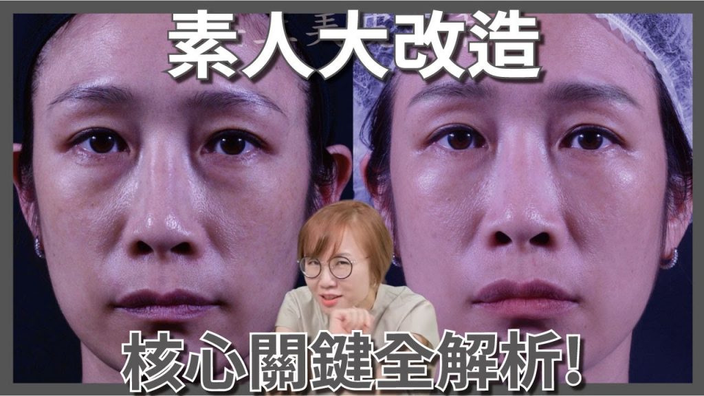 不需動手術就能變美?!微整形到底有多神奇?
