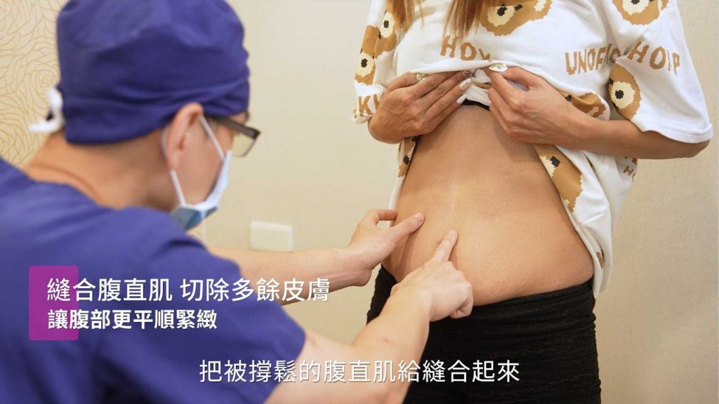 腹部拉皮手術必須做哪些事情?腹部拉皮手術方式說明 Dr.吳孟頴醫師