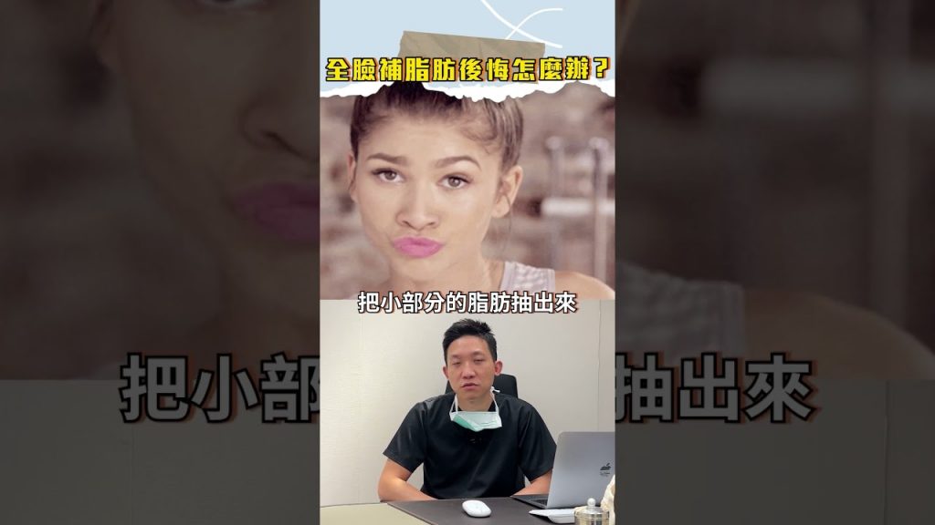 全臉補脂後悔了怎麼辦 有救嗎🥲 #林子宇醫師 #依心唯美 #依心唯美整形外科 #全臉補脂
