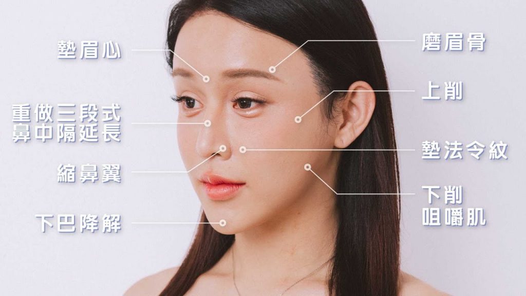 削骨後會讓臉部柔化嗎?臉部柔化手術心得分享 ~