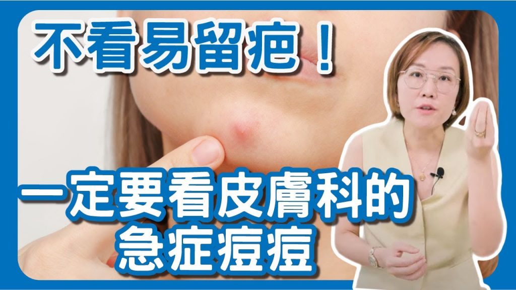 不看易留疤!一定要看皮膚科的急症痘痘?囊腫型青春痘的治療方式告訴你!