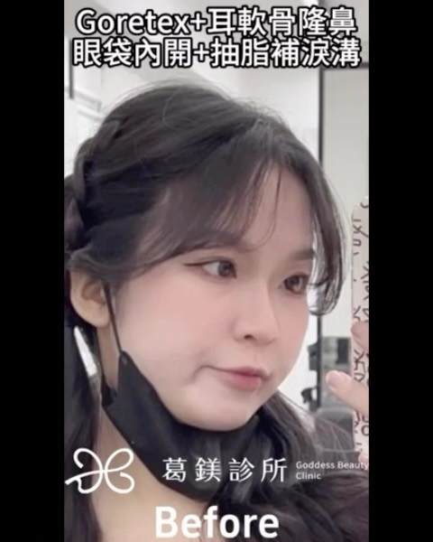 面相會顯示一個人的命運
其中鼻子代表了… | Ibeauty