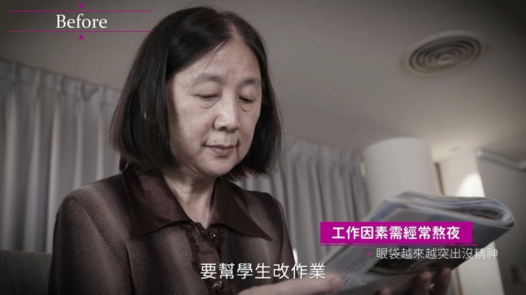 眼袋脂肪轉移複合式眼袋手術改善補教權威老師眼袋問題手術心得分享