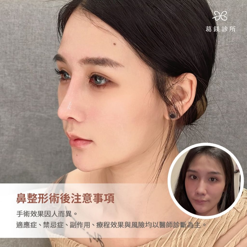 想要擁有完美的術後效果-最重要就是聽醫生… | Ibeauty