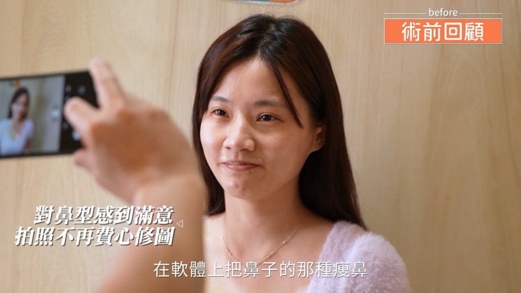 蒜頭鼻改善成網美鼻型的鼻整形隆鼻手術心得分享 ~